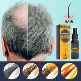 Dense Castor Oil Nutrient Solution, Hair Prevention, Moisturizing Hair Follicles Massage Repair Hair Hair - V.I.P Digital Presence
