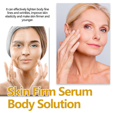 Anti-Wrinkle Treatment Spray Firming, Tender Skin, Anti-Wrinkle Neck Line Moisturizing Spray - V.I.P Digital Presence