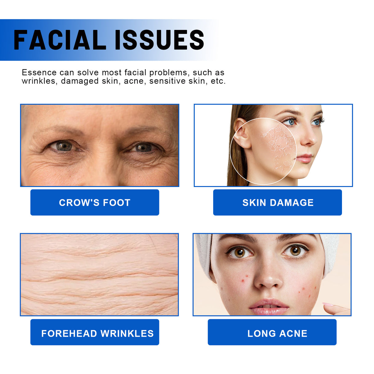 Blueberry Facial, Care Facial Skin Deep Cleansing Anti-Wrinkle Skin Care Essence Beauty Brightening Cream - V.I.P Digital Presence