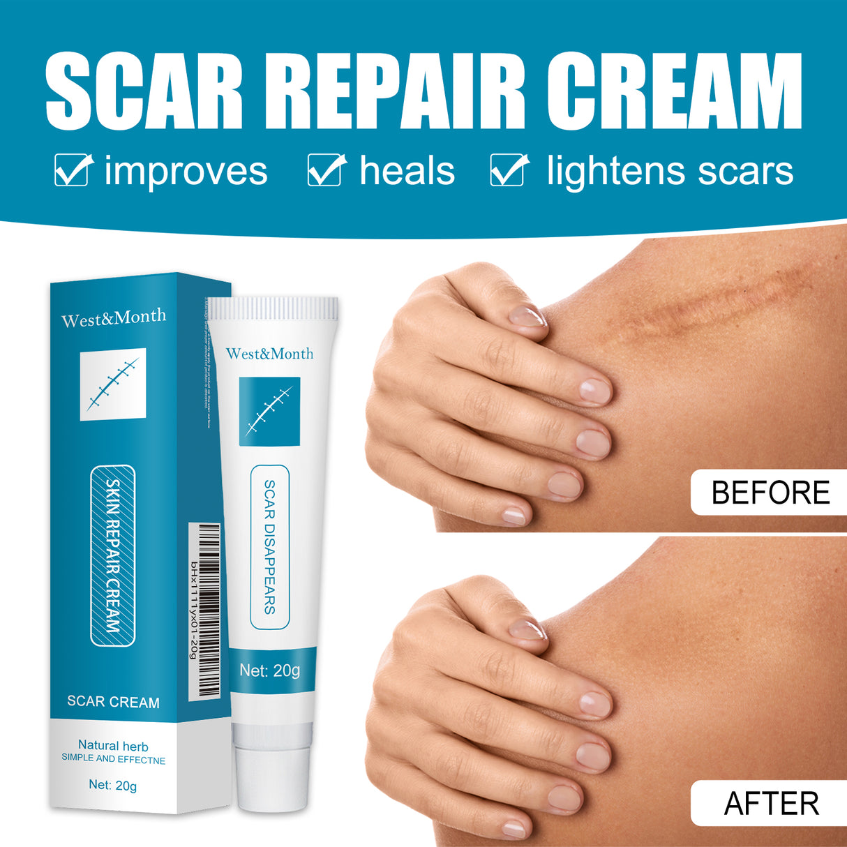 Skin Repair Cream Gentle Moisturizing Hydrating Moisturizing Repair Skin Care Repair Cream - V.I.P Digital Presence
