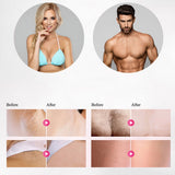 LippyTime IPL Laser Hair Removal - V.I.P Digital Presence