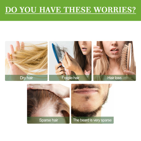 Hair Care Rosemary Oil, Anti-Loss Hair Nourish And Strengthen Hair Care Essential Oil - V.I.P Digital Presence