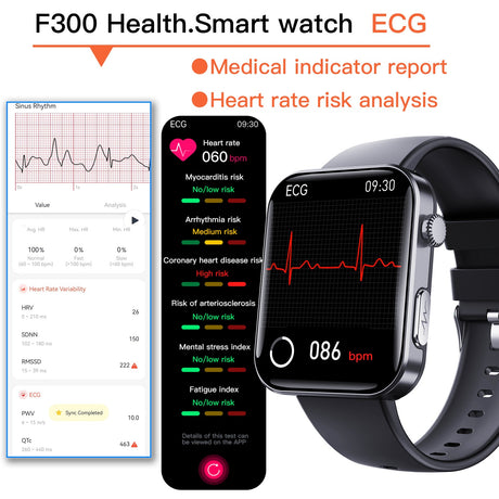 F300 smartwatch ECG electrocardiogram monitoring SOS fall alarm blood glucose and blood pressure watch HRV report - V.I.P Digital Presence