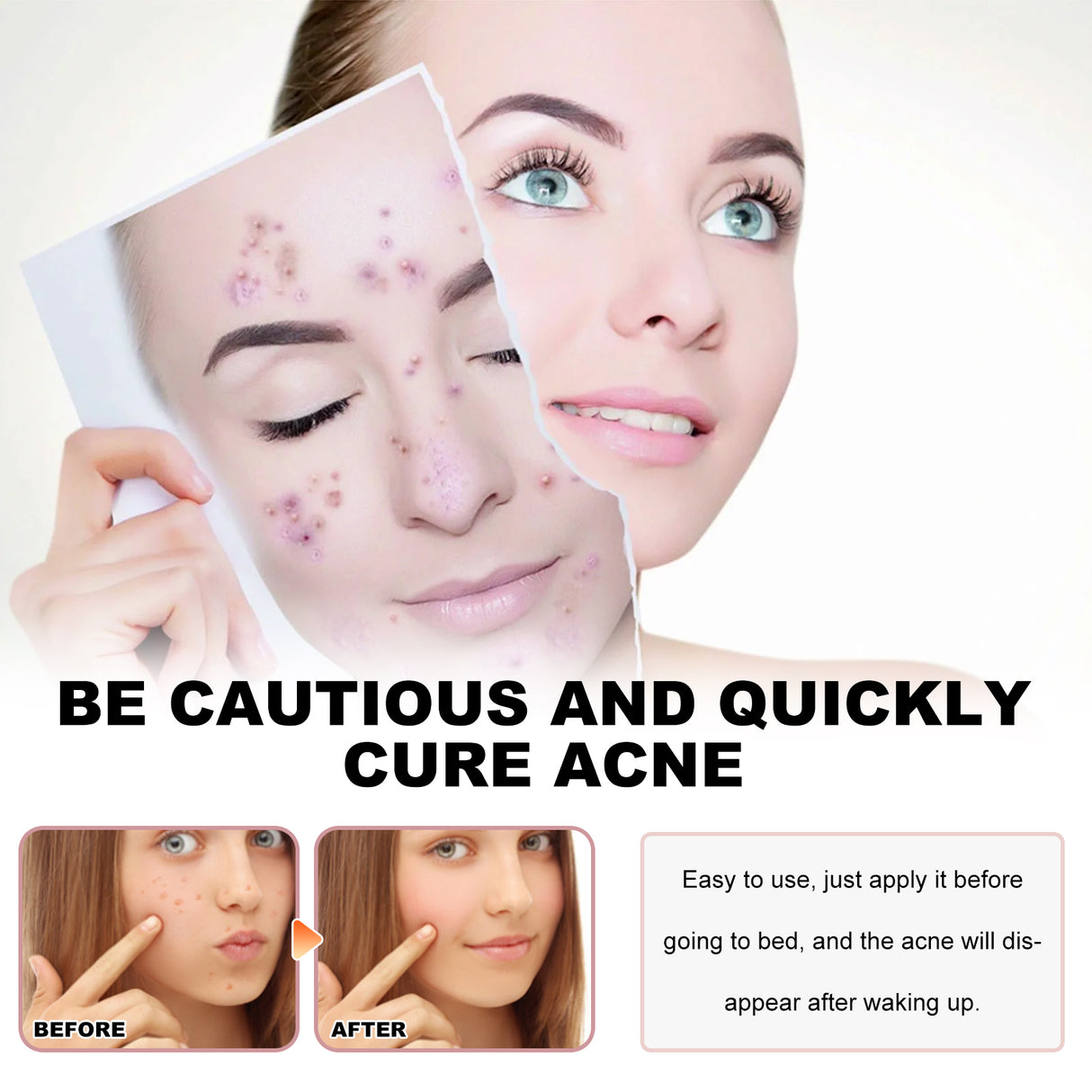 Parches para el acné con diseño de vida marina, aclara el acné, repara el acné, corrector facial y parche para el acné.