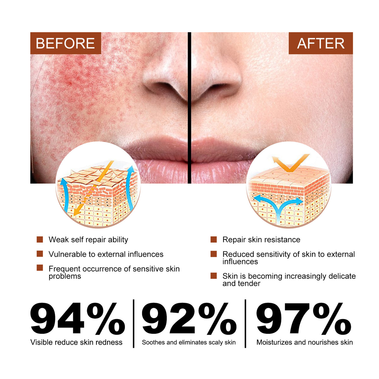 Erythematous Repair Essence, Repair Skin Lighten Facial Erythematous Moisturizing Essential Oil - V.I.P Digital Presence