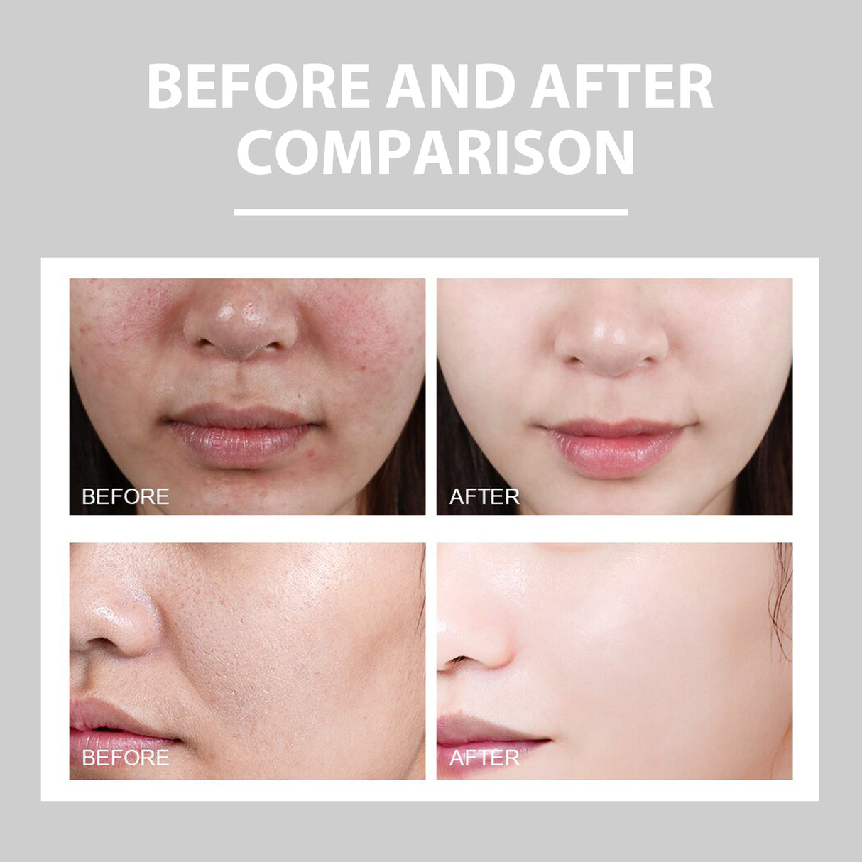 Hydrating Cream Hydrating And Lightening Facial Acne Repair Redness Hydrating And Brightening Moisturizing Cream - V.I.P Digital Presence