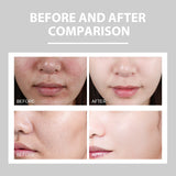 Hydrating Cream Hydrating And Lightening Facial Acne Repair Redness Hydrating And Brightening Moisturizing Cream - V.I.P Digital Presence
