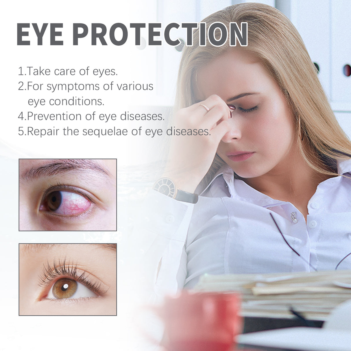 Eye Drops, Repair Eye Dry Tired Red And Giddy Eyes Care Solution - V.I.P Digital Presence