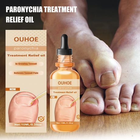 Anti-Nail Groove Relief Oil, Repair Inlaid Nails Gray Nails And Soft Thickening Nail Brightening Nails Care Oil - V.I.P Digital Presence