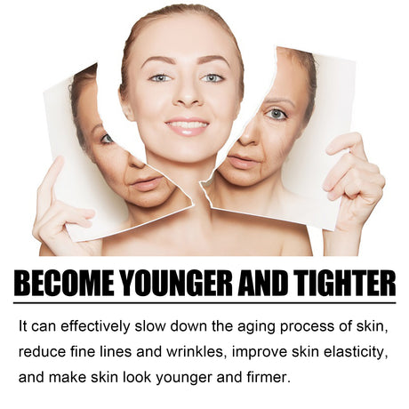 TCA 50 Skin Peel Serum, It Moisturizes Brightens The Firming Skin Fade Wrinkles This Skin Cream - V.I.P Digital Presence
