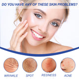 Facial Treatment Essence, Improve Fine Lines Lifting And Shrink Pore Acne Repair Moisturizing Essence - V.I.P Digital Presence