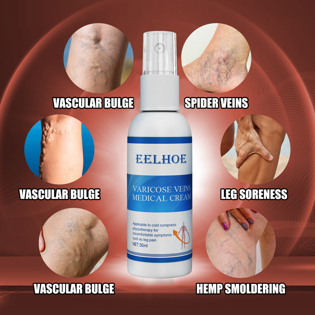 Intravenous Massage Spray For Varicose Veins Relief And Earthworm Leg Blood Vessel Bulge Pain Spray - V.I.P Digital Presence