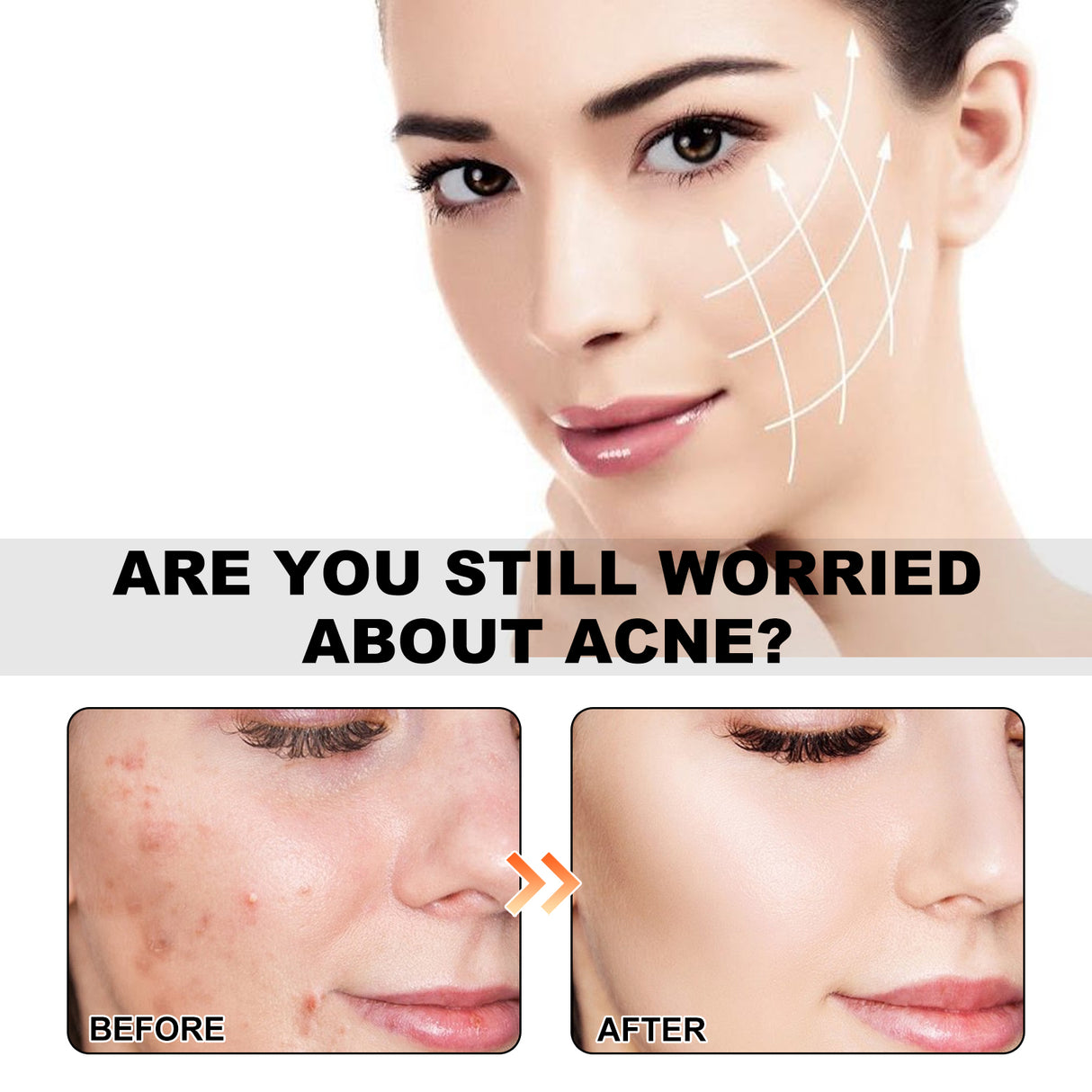 Parches para el acné con diseño de vida marina, aclara el acné, repara el acné, corrector facial y parche para el acné.