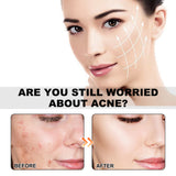 Parches para el acné con diseño de vida marina, aclara el acné, repara el acné, corrector facial y parche para el acné.
