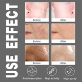 Men's Amino Acid Oil Control Face Wash, Deep Clean Acne Print Delicate Pores Whitening Brightening Skin - V.I.P Digital Presence