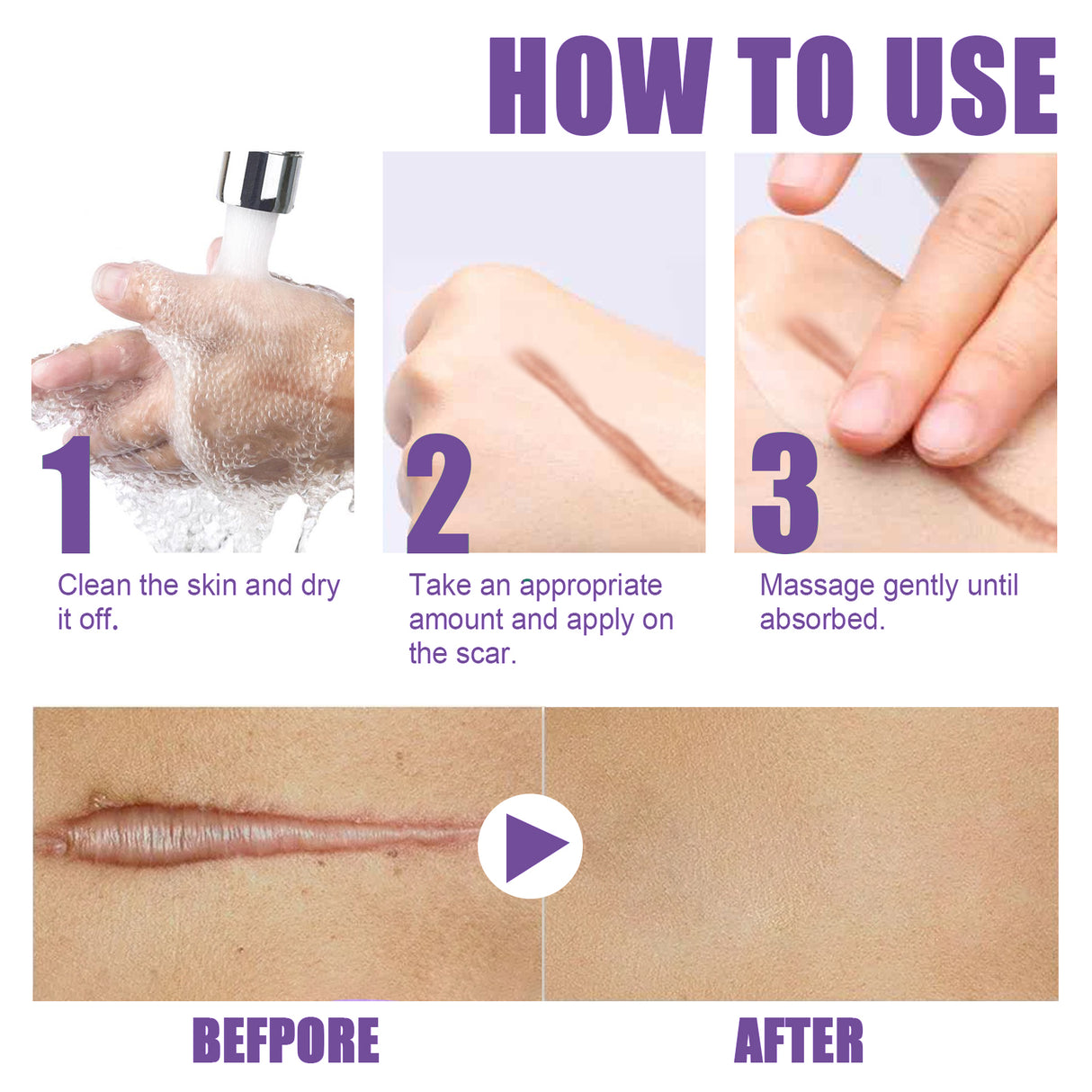 Skin Care Cream, Daily Moisturizing, Smoothing And Firming Skin Repair Postpartum Repair Topical Cream - V.I.P Digital Presence