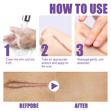 Skin Care Cream, Daily Moisturizing, Smoothing And Firming Skin Repair Postpartum Repair Topical Cream - V.I.P Digital Presence