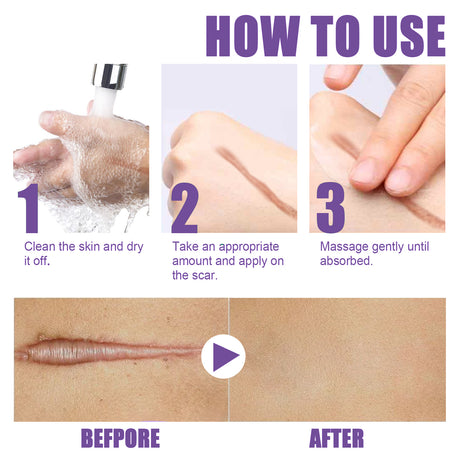 Skin Care Cream, Daily Moisturizing, Smoothing And Firming Skin Repair Postpartum Repair Topical Cream - V.I.P Digital Presence