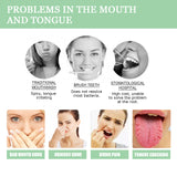 Fissured Tongue Relief Spray, Relieve Cracked Tongue And Fresh Breath Deodorizer Mouth Spray - V.I.P Digital Presence
