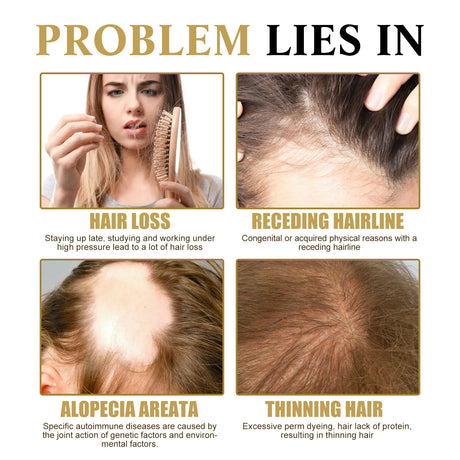 Ginseng Massage Essence, Moisturizes Scalp Strengthens Hair Prevents Loss Hair Care Essence - V.I.P Digital Presence