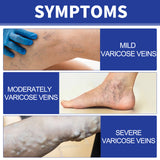Vein Comfort Spray, Relief Leg Muscle Soreness And Swelling Earthworm Leg Vein Treatment Spray - V.I.P Digital Presence