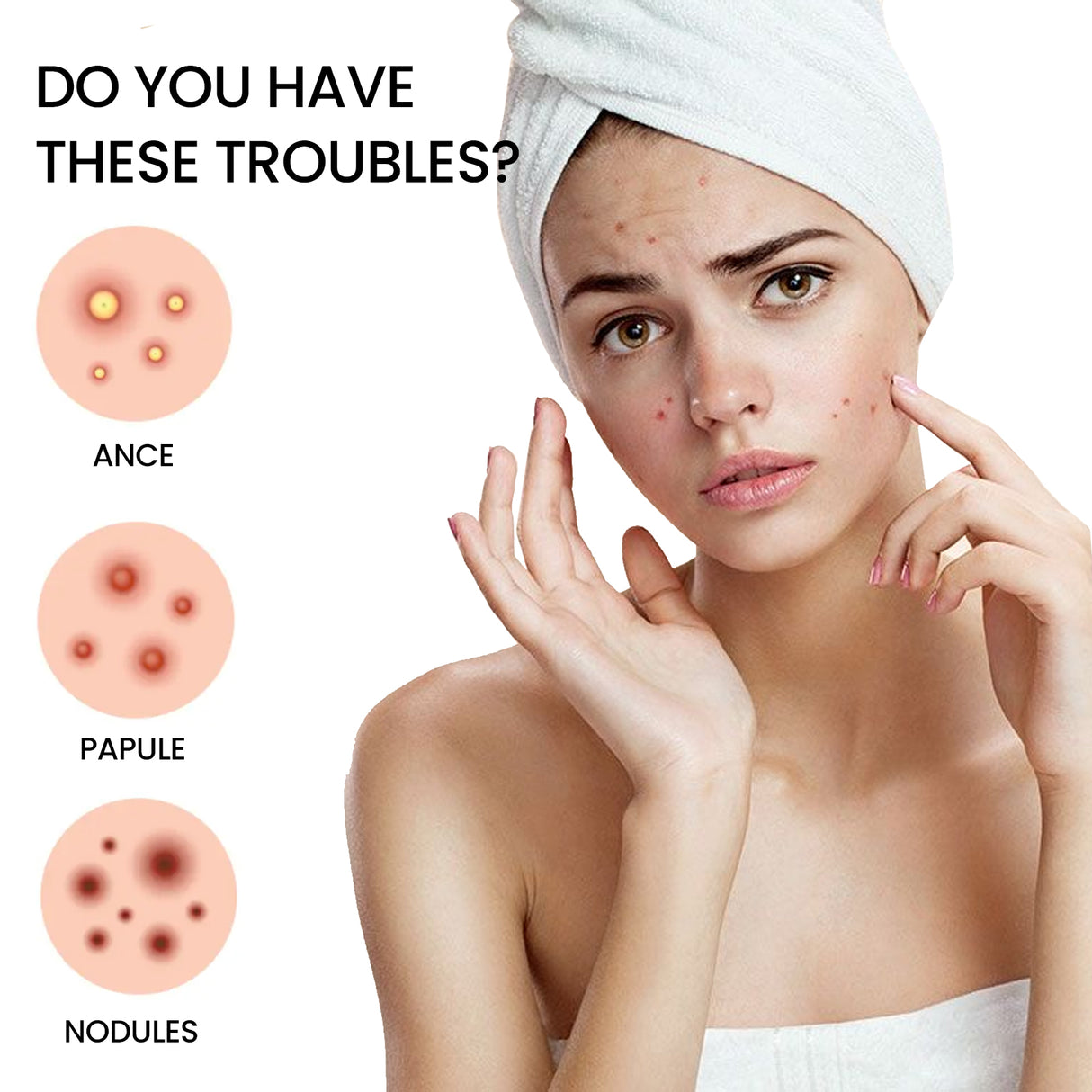 Parche para espinillas, repara marcas de viruela, aclara espinillas, cubre imperfecciones