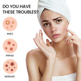 Parche para espinillas, repara marcas de viruela, aclara espinillas, cubre imperfecciones