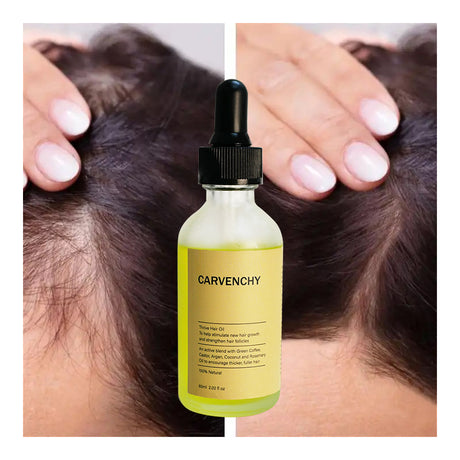 HAIR OIL Improves Dry Hair Organic Rosemary Hair Care Essential Oil - V.I.P Digital Presence
