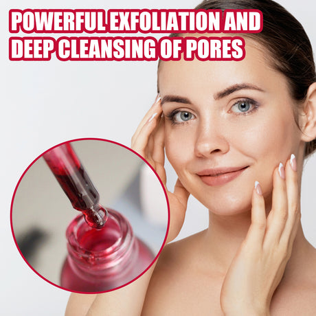 AHA30% + BHA 2% Fruit Acid Salicylic Acid Essence, Exfoliating Cleaning Blackheads Acne And Shrinking Pores Essence - V.I.P Digital Presence
