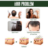 Ginger Dense Hair Spray Nourishes Hair Follicles, Prevents Hair Loss And Breaks, Moisturizes And Thickens Hair Spray - V.I.P Digital Presence