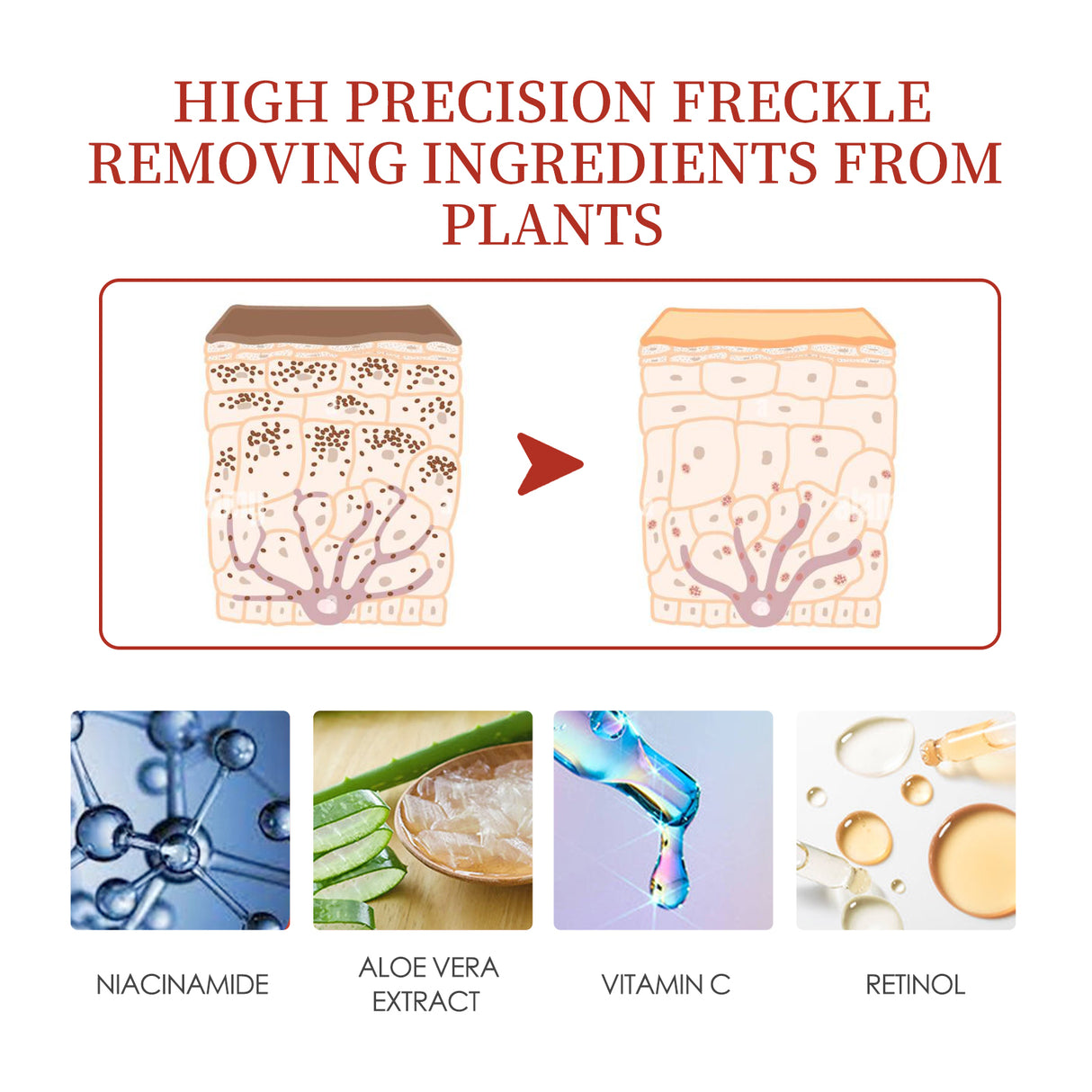 Pigment Repair Cream, Moisturizing And Lightening Freckles Dark Spots Spots Melasma Melanin Beauty Cream - V.I.P Digital Presence