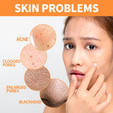 Ginger Yellow Mud Facial Mask Stick, Acne Removing Pore Shrinking Cleaning Solid Facial Mask - V.I.P Digital Presence