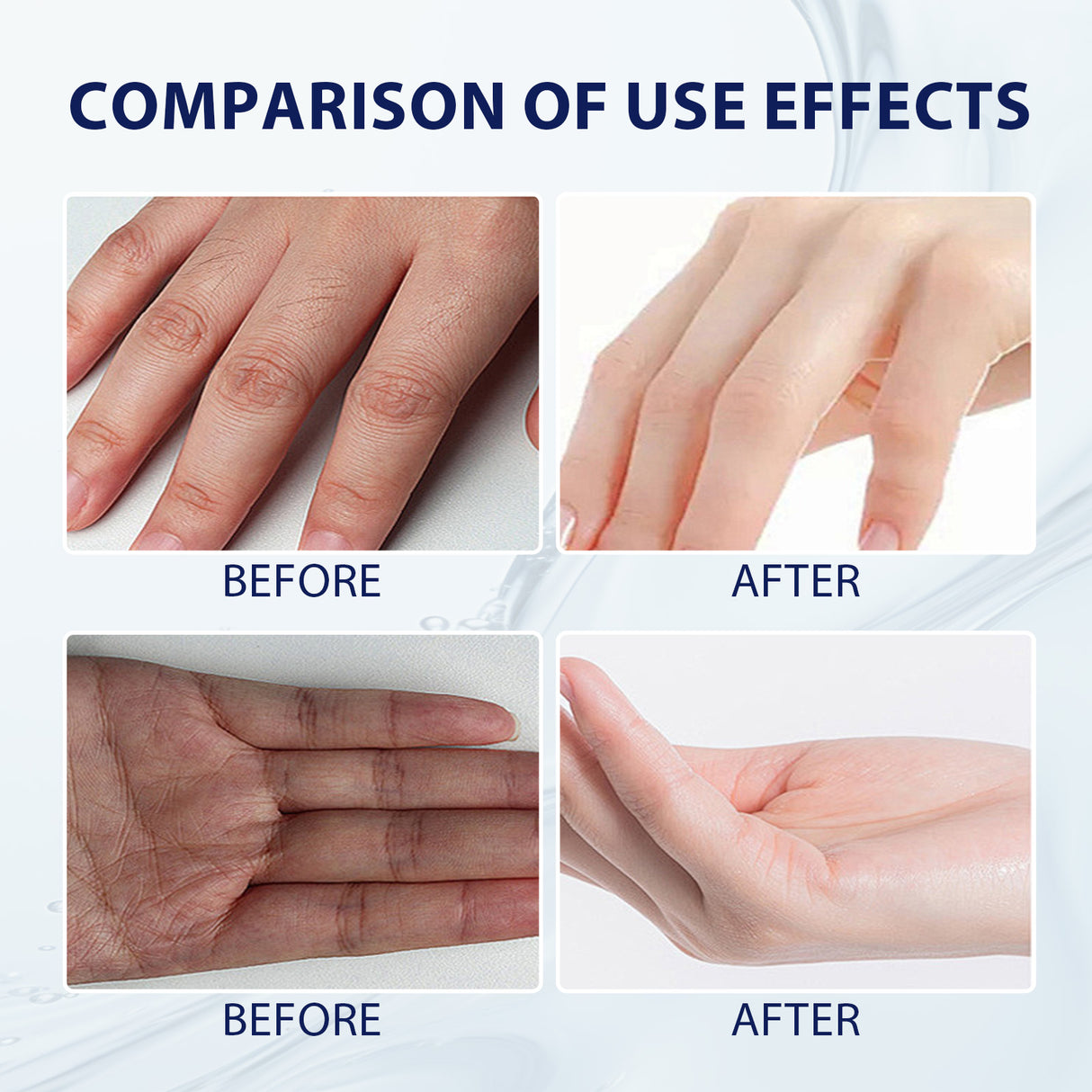 Aloe Vera Care Gel, Hydrating And Refreshing Moisturizing Cream Prevents Dryness And Cracks To Repair Hand Skin - V.I.P Digital Presence