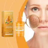 Aceite iluminador de cúrcuma y vitamina C, aceite esencial hidratante facial con vitamina C que hidrata, ilumina y nutre la piel.