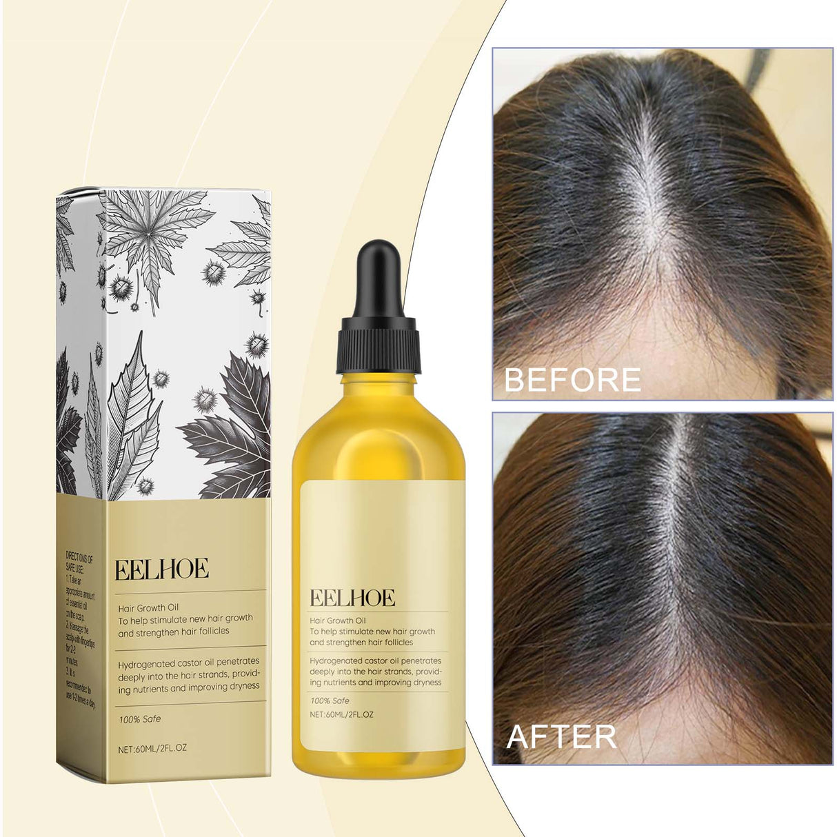 Castor Dense Hair Essential Oil Repair Dry And Damaged Scalp Hair Moist, Hydrating And Smoothing Hair - V.I.P Digital Presence