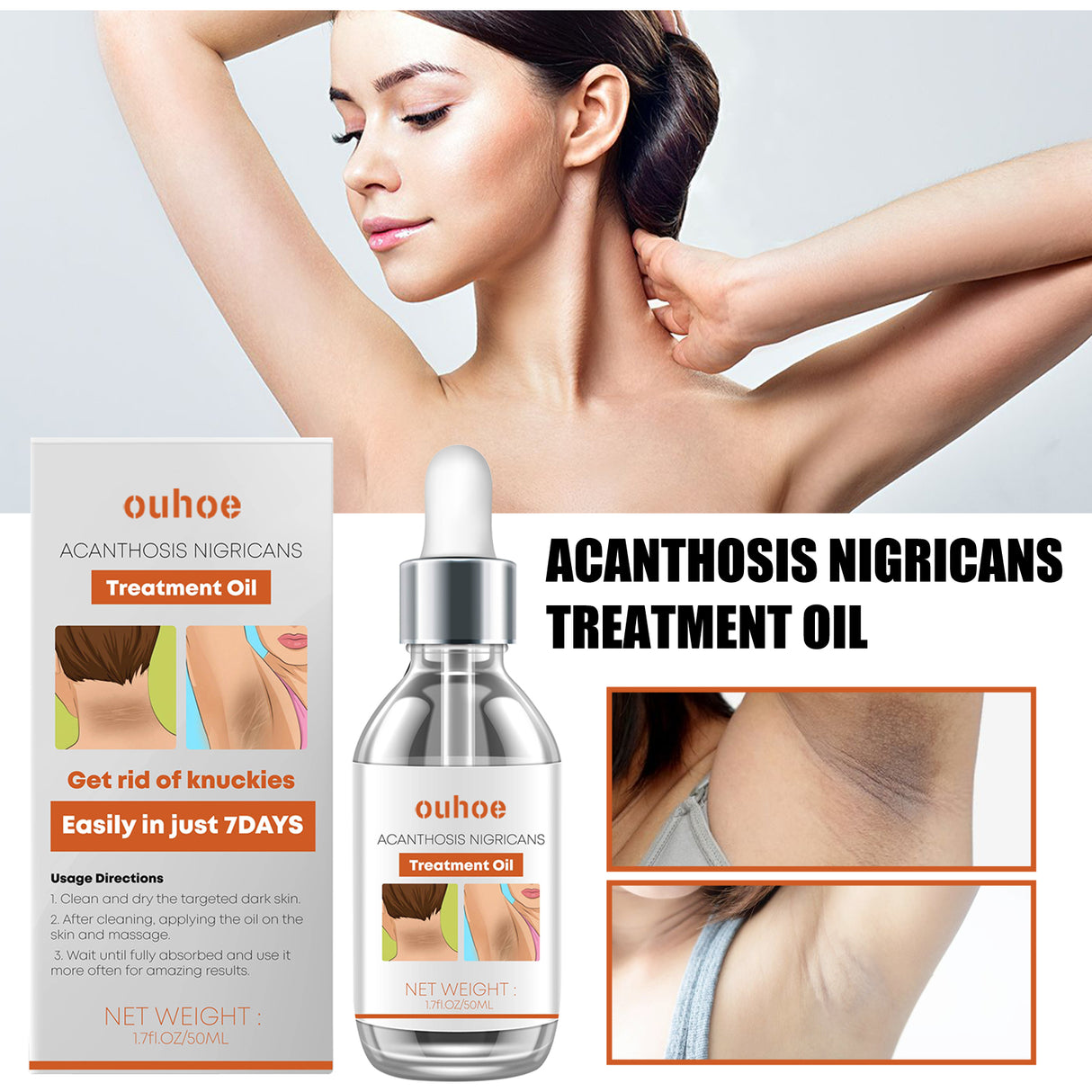 Black Wattle Essential Oil, Repair Underarm Joint Black Whitening Skin Light Spots Skin Beauty Essence Oil - V.I.P Digital Presence