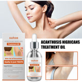 Black Wattle Essential Oil, Repair Underarm Joint Black Whitening Skin Light Spots Skin Beauty Essence Oil - V.I.P Digital Presence