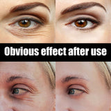 Astaxanthin Caviar Eye Cream, Moisturizing Skin Care Firming Fade Lines Eye Cream - V.I.P Digital Presence