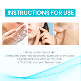 Acne Patch, Repair Facial Acne Invisible Concealer Hydrocolloid Patch - V.I.P Digital Presence
