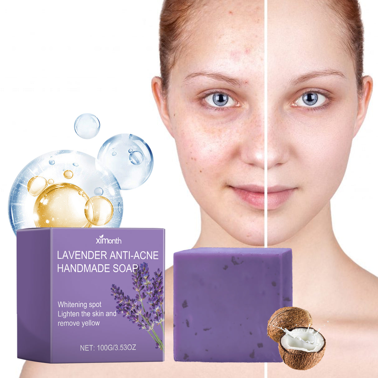 Lavender Oil Control Acne-Cleansing Soap For Cleansing Facial Skin Pores Oil Control Acne-Moisturizing Cleansing Soap - V.I.P Digital Presence