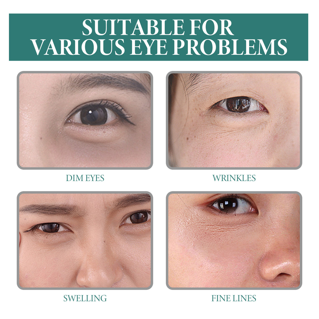 Puffy Eye Serum, Repair Essence Refreshing Hydrating Firming Brightens The Nicotinamide - V.I.P Digital Presence