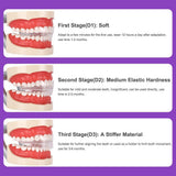 Transparent braces, exercise braces, orthodontic treatment for adults, shape retention correction, night wear prevention - V.I.P Digital Presence