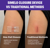CloseSeal Wound Closure Kit