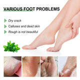 Peppermint Foot Cream, Repair The Foot Prevent Weather-Shack Desquamate Cracked Heels Moisturize Foot Care Cream - V.I.P Digital Presence