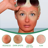 Color Correction Treatment Cream, Lighten Spots After Sun Repair Moisturizing Skin Beauty Cream - V.I.P Digital Presence