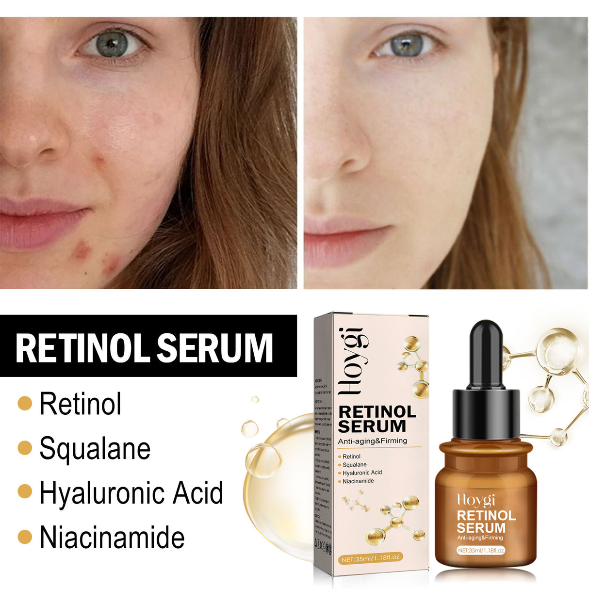 Retinol Anti-Wrinkle Essence Reduces Fine Lines, Firming, Moisturizing And Brightening Anti-Aging Essence - V.I.P Digital Presence