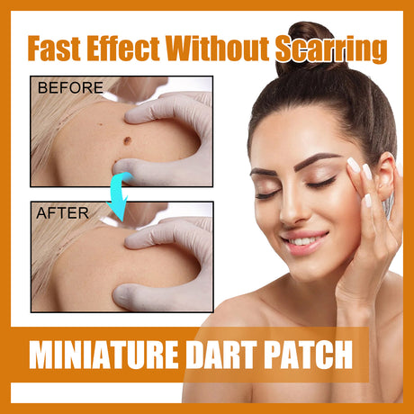 Mole Label Repair Patch, Repair Neck Flesh Grain Filamentary Wart Corns Skin Cleaning Gram Wart Patch - V.I.P Digital Presence