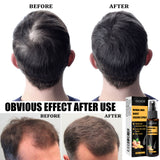 Herbal Hair Essence Spray,Prevent Falling Hair And Scalp Moisturizing And Nourishing Solution - V.I.P Digital Presence