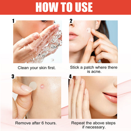 Hydrocolloid Acne Patch Face Invisible Makeup Closed Mouth Acne Clear Acne Waterproof Breathable Facial Treatment - V.I.P Digital Presence