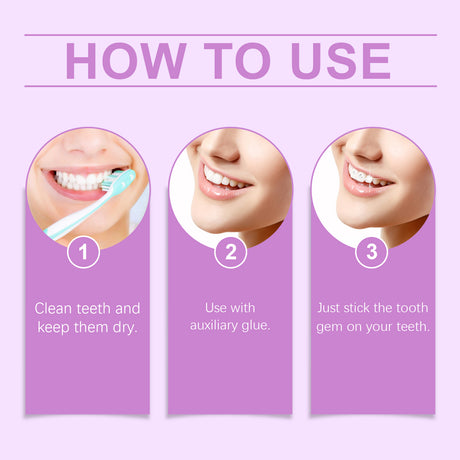 Crystal Dental Diamond Sparkle Dental Diamond Decorative Fashion Beauty Stickers To Enhance Smile Light Portable Crystal Dental Diamond - V.I.P Digital Presence